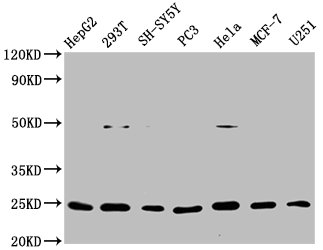 Western Blot
Positive WB detected in: HepG2 whole cell lysate, 293T whole cell lysate, SH-SY5Y whole cell lysate, PC3 whole cell lysate, Hela whole cell lysate, MCF-7 whole cell lysate, U251 whole cell lysate
All lanes: GDNF antibody at 1μg/ml
Secondary
Goat polyclonal to rabbit IgG at 1/50000 dilution
Predicted band size: 24, 21, 26, 23, 19 KDa
Observed band size: 24 KDa
