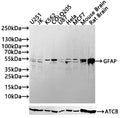 Western Blot
Positive WB detected in: MCF7 whole cell lysate,Mouse Brain tissue lysate,Rat Brain tissue lysate
All lanes: GFAP antibody at 1:1000
Secondary
Goat polyclonal to mouse IgG at 1/50000 dilution
Predicted band size: 50 kDa
Observed band size: 55 kDa