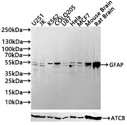 Western Blot
Positive WB detected in: MCF7 whole cell lysate,Mouse Brain tissue lysate,Rat Brain tissue lysate
All lanes: GFAP antibody at 1:1000
Secondary
Goat polyclonal to mouse IgG at 1/50000 dilution
Predicted band size: 50 kDa
Observed band size: 55 kDa
