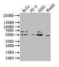 Western Blot
Positive WB detected in:Hela whole cell lysate, PC-3 whole cell lysate, U251 whole cell lysate, HepG2 whole cell lysate
All lanes: GIPR antibody at 1:1000
Secondary
Goat polyclonal to human IgG at 1/50000 dilution
Predicted band size: 54 kDa,49 kDa,50 kDa
Observed band size: 54 kDa