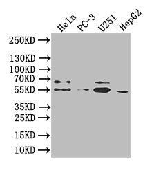 Western Blot
Positive WB detected in:Hela whole cell lysate, PC-3 whole cell lysate, U251 whole cell lysate, HepG2 whole cell lysate
All lanes: GIPR antibody at 1:1000
Secondary
Goat polyclonal to human IgG at 1/50000 dilution
Predicted band size: 54 kDa,49 kDa,50 kDa
Observed band size: 54 kDa