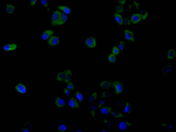 Immunofluorescence staining of Hela cell with CSB-RA009514MA2HU at 1:30, counter-stained with DAPI. The cells were fixed in 4% formaldehyde and blocked in 10% normal Goat Serum. The cells were then incubated with the antibody overnight at 4C. The secondary antibody was FITC-conjugated AffiniPure Goat Anti-Human IgG(H+L) .