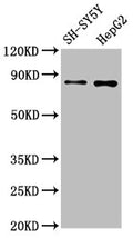 Western Blot
Positive WB detected in: SH-SY5Y whole cell lysate, HepG2 whole cell lysate
All lanes: GOLM1 antibody at 1.3μg/ml
Secondary
Goat polyclonal to rabbit IgG at 1/50000 dilution
Predicted band size: 46, 45 KDa
Observed band size: 80 KDa
