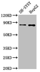 Western Blot
Positive WB detected in: SH-SY5Y whole cell lysate, HepG2 whole cell lysate
All lanes: GOLM1 antibody at 1.3μg/ml
Secondary
Goat polyclonal to rabbit IgG at 1/50000 dilution
Predicted band size: 46, 45 KDa
Observed band size: 80 KDa