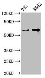 Western Blot
Positive WB detected in: 293 whole cell lysate, K562 whole cell lysate
All lanes: GPC3 antibody at 0.9μg/ml
Secondary
Goat polyclonal to rabbit IgG at 1/50000 dilution
Predicted band size: 66, 60, 69 KDa
Observed band size: 66 KDa