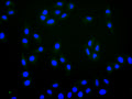 Immunofluorescence staining of Hela cell with CSB-RA020519MA1HU at 1:30 ,counter-stained with DAPI. The cells were fixed in 4% formaldehyde, permeabilized using 0.2% Triton X-100 and blocked in 10% normal Goat Serum. The cells were then incubated with the antibody overnight at 4°C. The secondary antibody was Fluorescein (FITC) AffiniPure Goat Anti-Human IgG, Fcγ fragment specific.