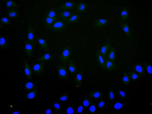 Immunofluorescence staining of Hela cell with CSB-RA020519MA1HU at 1:30 ,counter-stained with DAPI. The cells were fixed in 4% formaldehyde, permeabilized using 0.2% Triton X-100 and blocked in 10% normal Goat Serum. The cells were then incubated with the antibody overnight at 4°C. The secondary antibody was Fluorescein (FITC) AffiniPure Goat Anti-Human IgG, Fcγ fragment specific.