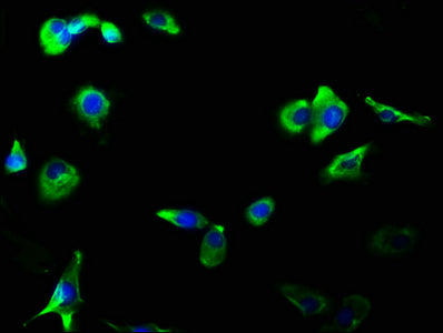 Immunofluorescence staining of MCF-7 cells with CSB-RA009900A0HU at 1:56, counter-stained with DAPI. The cells were fixed in 4% formaldehyde, permeabilized using 0.2% Triton X-100 and blocked in 10% normal Goat Serum. The cells were then incubated with the antibody overnight at 4℃. The secondary antibody was Alexa Fluor 488-congugated AffiniPure Goat Anti-Rabbit IgG (H+L) .