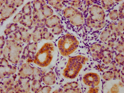 IHC image of CSB-RA009962A216phHU diluted at 1:100 and staining in paraffin-embedded human pancreatic tissue performed on a Leica BondTM system. After dewaxing and hydration, antigen retrieval was mediated by high pressure in a citrate buffer (pH 6.0) . Section was blocked with 10% normal goat serum 30min at RT. Then primary antibody (1% BSA) was incubated at 4℃ overnight. The primary is detected by a biotinylated secondary antibody and visualized using an HRP conjugated SP system.