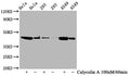 Western Blot
Positive WB detected in Hela whole cell lysate,293 whole cell lysate,A549 whole cell lysate(treated with Calyculin A or not) 
All lanes Phospho-GSK3B antibody at 0.77μg/ml
Secondary
Goat polyclonal to rabbit IgG at 1/50000 dilution
Predicted band size: 46 KDa
Observed band size: 46 KDa