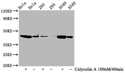 Western Blot
Positive WB detected in Hela whole cell lysate,293 whole cell lysate,A549 whole cell lysate(treated with Calyculin A or not) 
All lanes Phospho-GSK3B antibody at 0.77μg/ml
Secondary
Goat polyclonal to rabbit IgG at 1/50000 dilution
Predicted band size: 46 KDa
Observed band size: 46 KDa