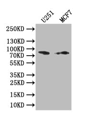Western Blot
Positive WB detected in: U251 whole cell lysate, MCF7 whole cell lysate
All lanes: GSN antibody at 1:1000
Secondary
Goat polyclonal to rabbit IgG at 1/50000 dilution
Predicted band size: 85 kDa
Observed band size: 85 kDa