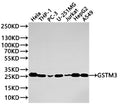 Western Blot
Positive WB detected in: HeLa whole cell lysate(20µg) , THP-1 whole cell lysate(20µg) , PC-3 whole cell lysate(20µg) , U-251MG whole cell lysate(20µg) , Jurkat whole cell lysate(20µg) , HepG2 whole cell lysate(20µg) , A549 whole cell lysate(20µg) 
All lanes: GSTM3 antibody at 1:1000
Secondary
Goat polyclonal to rabbit IgG at 1/40000 dilution
Predicted band size: 27 kDa
Observed band size: 27 kDa
Exposure time：2min