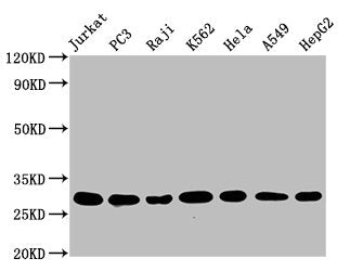 Western Blot
Positive WB detected in: Jurkat whole cell lysate, PC3 whole cell lysate, Raji whole cell lysate, K562 whole cell lysate, Hela whole cell lysate, A549 whole cell lysate, HepG2 whole cell lysate
All lanes: GSTO1 antibody at 1.25μg/ml
Secondary
Goat polyclonal to rabbit IgG at 1/50000 dilution
Predicted band size: 28, 24, 25 KDa
Observed band size: 28 KDa