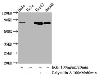 Western Blot
Positive WB detected in Hela whole cell lysate,HepG2 whole cell lysate(treated with Calyculin A or EGF) 
All lanes Phospho-GYS1 antibody at 1.12μg/ml
Secondary
Goat polyclonal to rabbit IgG at 1/50000 dilution
Predicted band size: 85 KDa
Observed band size: 85 KDa