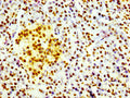 IHC image of CSB-RA010109A0HU diluted at 1:100 and staining in paraffin-embedded human pancreatic tissue performed on a Leica BondTM system. After dewaxing and hydration, antigen retrieval was mediated by high pressure in a citrate buffer (pH 6.0) . Section was blocked with 10% normal goat serum 30min at RT. Then primary antibody (1% BSA) was incubated at 4℃ overnight. The primary is detected by a biotinylated secondary antibody and visualized using an HRP conjugated SP system.