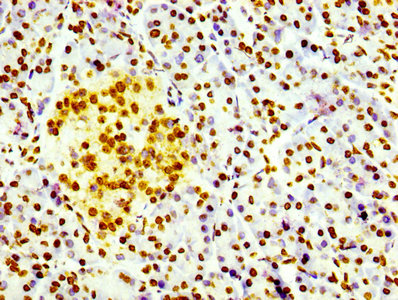 IHC image of CSB-RA010109A0HU diluted at 1:100 and staining in paraffin-embedded human pancreatic tissue performed on a Leica BondTM system. After dewaxing and hydration, antigen retrieval was mediated by high pressure in a citrate buffer (pH 6.0) . Section was blocked with 10% normal goat serum 30min at RT. Then primary antibody (1% BSA) was incubated at 4℃ overnight. The primary is detected by a biotinylated secondary antibody and visualized using an HRP conjugated SP system.