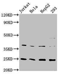 Western Blot
Positive WB detected in: Jurkat whole cell lysate, Hela whole cell lysate, HepG2 whole cell lysate, 293 whole cell lysate
All lanes: HAMP antibody at 2.15μg/ml
Secondary
Goat polyclonal to rabbit IgG at 1/50000 dilution
Predicted band size: 10 KDa
Observed band size: 25 KDa