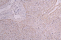IHC image of CSB-RA010144MA1HU diluted at 1:300 and staining in paraffin-embedded human liver tissue performed on a Leica BondTM system. After dewaxing and hydration, antigen retrieval was mediated by high pressure in a citrate buffer (pH 6.0) . Section was blocked with 10% normal goat serum 30min at RT. Then primary antibody (1% BSA) was incubated at 4°C overnight. The primary is detected by a Goat anti-Human IgG labeled by HRP and visualized using 0.05% DAB.