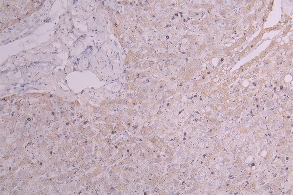 IHC image of CSB-RA010144MA1HU diluted at 1:300 and staining in paraffin-embedded human liver tissue performed on a Leica BondTM system. After dewaxing and hydration, antigen retrieval was mediated by high pressure in a citrate buffer (pH 6.0) . Section was blocked with 10% normal goat serum 30min at RT. Then primary antibody (1% BSA) was incubated at 4°C overnight. The primary is detected by a Goat anti-Human IgG labeled by HRP and visualized using 0.05% DAB.