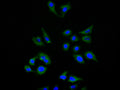 Immunofluorescence staining of Hela cell with CSB-RA010145MA1HU at 1:150, counter-stained with DAPI. The cells were fixed in 4% formaldehyde and blocked in 10% normal Goat Serum. The cells were then incubated with the antibody overnight at 4C. The secondary antibody was FITC-conjugated AffiniPure Goat Anti-Human IgG(H+L) .