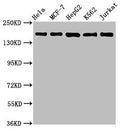 Western Blot
Positive WB detected in: Hela whole cell lysate, MCF-7 whole cell lysate, HepG2 whole cell lysate, K562 whole cell lysate, Jurkat whole cell lysate
All lanes: HDAC6 antibody at 1.1μg/ml
Secondary
Goat polyclonal to rabbit IgG at 1/50000 dilution
Predicted band size: 132, 115 KDa
Observed band size: 160 KDa
