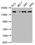 Western Blot
Positive WB detected in: Hela whole cell lysate, MCF-7 whole cell lysate, 293T whole cell lysate, K562 whole cell lysate
All lanes: HDAC9 antibody at 1.54μg/ml
Secondary
Goat polyclonal to rabbit IgG at 1/50000 dilution
Predicted band size: 112, 102, 66, 98, 118, 113, 61, 63, 58 KDa
Observed band size: 160 KDa