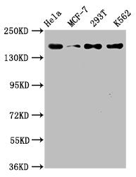 Western Blot
Positive WB detected in: Hela whole cell lysate, MCF-7 whole cell lysate, 293T whole cell lysate, K562 whole cell lysate
All lanes: HDAC9 antibody at 1.54μg/ml
Secondary
Goat polyclonal to rabbit IgG at 1/50000 dilution
Predicted band size: 112, 102, 66, 98, 118, 113, 61, 63, 58 KDa
Observed band size: 160 KDa