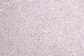 IHC image of CSB-RA010327MA1HU diluted at 1:100 and staining in paraffin-embedded human Liver tissue performed on a Leica BondTM system. After dewaxing and hydration, antigen retrieval was mediated by high pressure in a citrate buffer (pH 6.0) . Section was blocked with 10% normal goat serum 30min at RT. Then primary antibody (1% BSA) was incubated at 4°C overnight. The primary is detected by a Goat anti-Human IgG labeled by HRP and visualized using 0.05% DAB.