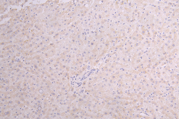IHC image of CSB-RA010327MA1HU diluted at 1:100 and staining in paraffin-embedded human Liver tissue performed on a Leica BondTM system. After dewaxing and hydration, antigen retrieval was mediated by high pressure in a citrate buffer (pH 6.0) . Section was blocked with 10% normal goat serum 30min at RT. Then primary antibody (1% BSA) was incubated at 4°C overnight. The primary is detected by a Goat anti-Human IgG labeled by HRP and visualized using 0.05% DAB.
