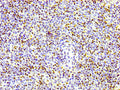 IHC image of CSB-RA010380A17phHU diluted at 1:100 and staining in paraffin-embedded human lymph node tissue performed on a Leica BondTM system. After dewaxing and hydration, antigen retrieval was mediated by high pressure in a citrate buffer (pH 6.0) . Section was blocked with 10% normal goat serum 30min at RT. Then primary antibody (1% BSA) was incubated at 4℃ overnight. The primary is detected by a biotinylated secondary antibody and visualized using an HRP conjugated SP system.