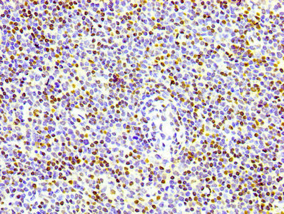 IHC image of CSB-RA010380A17phHU diluted at 1:100 and staining in paraffin-embedded human lymph node tissue performed on a Leica BondTM system. After dewaxing and hydration, antigen retrieval was mediated by high pressure in a citrate buffer (pH 6.0) . Section was blocked with 10% normal goat serum 30min at RT. Then primary antibody (1% BSA) was incubated at 4℃ overnight. The primary is detected by a biotinylated secondary antibody and visualized using an HRP conjugated SP system.