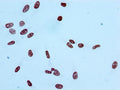 Immunocytochemistry analysis of CSB-RA010385A09acHU diluted at 1:100 and staining in Hela cells performed on a Leica BondTM system. After dewaxing and hydration, antigen retrieval was mediated by high pressure in a citrate buffer (pH 6.0) . Section was blocked with 10% normal goat serum 30min at RT. Then primary antibody (1% BSA) was incubated at 4℃ overnight. The primary is detected by a biotinylated secondary antibody and visualized using an HRP conjugated SP system.