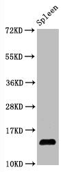Western Blot
Positive WB detected in Mouse spleen tissue
All lanes Hydroxyl-Histone H2A type 1-B/E (Y39) antibody at 1.05μg/ml
Secondary
Goat polyclonal to rabbit IgG at 1/50000 dilution
Predicted band size: 14 KDa
Observed band size: 14 KDa