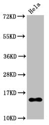 Western Blot
Positive WB detected in Hela whole cell lysate treated by 15mM sodium butyrate for 30min
All lanes Acetyl-Histone H2B type 1-B(K20) antibody at 0.135μg/ml
Secondary
Goat polyclonal to rabbit IgG at 1/50000 dilution
Predicted band size: 15 KDa
Observed band size: 15 KDa