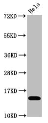 Western Blot
Positive WB detected in Hela whole cell lysate treated by 15mM sodium butyrate for 30min
All lanes Acetyl-Histone H3.1(K4) antibody at 1.1μg/ml
Secondary
Goat polyclonal to rabbit IgG at 1/50000 dilution
Predicted band size: 15 KDa
Observed band size: 15 KDa