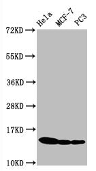 Western Blot
Positive WB detected in Hela whole cell lysate, MCF-7 whole cell lysate, PC3 whole cell lysate
All lanes Phospho-Histone H3.1(S10) antibody at 0.5μg/ml
Secondary
Goat polyclonal to rabbit IgG at 1/50000 dilution
Predicted band size: 15 KDa
Observed band size: 15 KDa