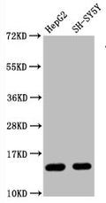 Western Blot
Positive WB detected in HepG2 whole cell lysate, SH-SY5Y whole cell lysate
All lanes Mono-methyl-Histone H3.1(R128) antibody at 0.87μg/ml
Secondary
Goat polyclonal to rabbit IgG at 1/50000 dilution
Predicted band size: 15 KDa
Observed band size: 15 KDa