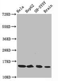 Western Blot
Positive WB detected in Hela whole cell lysate, HepG2 whole cell lysate, SH-SY5Y whole cell lysate, Rat brain tissue
All lanes Acetyl-Histone H3.1(K14) antibody at 0.75μg/ml
Secondary
Goat polyclonal to rabbit IgG at 1/50000 dilution
Predicted band size: 15 KDa
Observed band size: 15 KDa