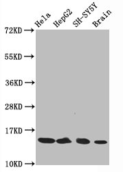 Western Blot
Positive WB detected in Hela whole cell lysate, HepG2 whole cell lysate, SH-SY5Y whole cell lysate, Rat brain tissue
All lanes Acetyl-Histone H3.1(K14) antibody at 0.75μg/ml
Secondary
Goat polyclonal to rabbit IgG at 1/50000 dilution
Predicted band size: 15 KDa
Observed band size: 15 KDa