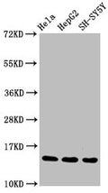 Western Blot
Positive WB detected in Hela whole cell lysate, HepG2 whole cell lysate, SH-SY5Y whole cell lysate
All lanes Mono-methyl-Histone H3.1(R17) antibody at 1.55μg/ml
Secondary
Goat polyclonal to rabbit IgG at 1/50000 dilution
Predicted band size: 15 KDa
Observed band size: 15 KDa