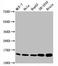 Western Blot
Positive WB detected in MCF-7 whole cell lysate, Hela whole cell lysate, HepG2 whole cell lysate, SH-SY5Y whole cell lysate,Rat brain tissue
All lanes Mono-methyl-Histone H3.1(K18) antibody at 0.7μg/ml
Secondary
Goat polyclonal to rabbit IgG at 1/50000 dilution
Predicted band size: 15 KDa
Observed band size: 15 KDa