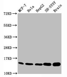 Western Blot
Positive WB detected in MCF-7 whole cell lysate, Hela whole cell lysate, HepG2 whole cell lysate, SH-SY5Y whole cell lysate,Rat brain tissue
All lanes Mono-methyl-Histone H3.1(K18) antibody at 0.7μg/ml
Secondary
Goat polyclonal to rabbit IgG at 1/50000 dilution
Predicted band size: 15 KDa
Observed band size: 15 KDa