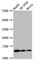 Western Blot
Positive WB detected in HepG2 whole cell lysate, SH-SY5Y whole cell lysate,  Rat brain tissue
All lanes Mono-methyl-Histone H3.1(K36) antibody at 0.6μg/ml
Secondary
Goat polyclonal to rabbit IgG at 1/50000 dilution
Predicted band size: 15 KDa
Observed band size: 15 KDa