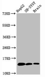 Western Blot
Positive WB detected in HepG2 whole cell lysate, SH-SY5Y whole cell lysate,  Rat brain tissue
All lanes Mono-methyl-Histone H3.1(K36) antibody at 0.6μg/ml
Secondary
Goat polyclonal to rabbit IgG at 1/50000 dilution
Predicted band size: 15 KDa
Observed band size: 15 KDa