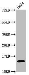Western BlotPositive WB detected in:Hela whole cell lysate treated by 15mM sodium butyrate for 30minAll lanes:Acetyl-Histone H3.1(K56) antibody at 0.7μg/mlSecondaryGoat polyclonal to rabbit IgG at 1/50000 dilutionPredicted band size: 15 KDaObserved band size: 15 KDa
