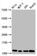 Western Blot
Positive WB detected in Hela whole cell lysate, MCF-7 whole cell lysate, 293 whole cell lysate, HepG2 whole cell lysate
All lanes Acetyl-Histone H4 (K5) antibody at 1.05μg/ml
Secondary
Goat polyclonal to rabbit IgG at 1/50000 dilution
Predicted band size: 11 KDa
Observed band size: 11 KDa