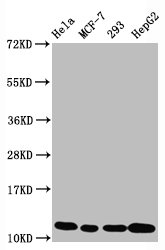 Western Blot
Positive WB detected in Hela whole cell lysate, MCF-7 whole cell lysate, 293 whole cell lysate, HepG2 whole cell lysate
All lanes Acetyl-Histone H4 (K5) antibody at 1.05μg/ml
Secondary
Goat polyclonal to rabbit IgG at 1/50000 dilution
Predicted band size: 11 KDa
Observed band size: 11 KDa