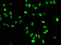 Immunofluorescence staining of Hela cells with CSB-RA010429A16me1HU at 1:50,counter-stained with DAPI. The cells were fixed in 4% formaldehyde, permeabilized using 0.2% Triton X-100 and blocked in 10% normal Goat Serum. The cells were then incubated with the antibody overnight at 4℃.The secondary antibody was Alexa Fluor 488-congugated AffiniPure Goat Anti-Rabbit IgG (H+L) .