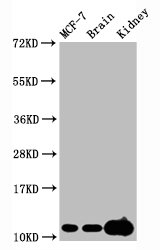 Western Blot
Positive WB detected in MCF-7 whole cell lysate,  Mouse brain tissue,Mouse kidney tissue
All lanes Tri-methyl-Histone H4 (K20) antibody at 2.15μg/ml
Secondary
Goat polyclonal to rabbit IgG at 1/50000 dilution
Predicted band size: 11 KDa
Observed band size: 11 KDa